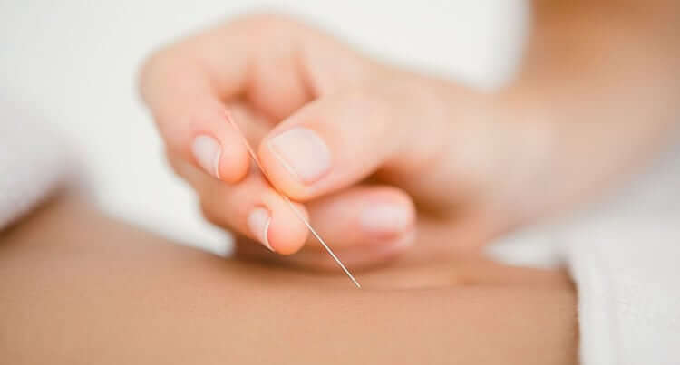 Informatii interesante despre acupunctura si utilizarile ei