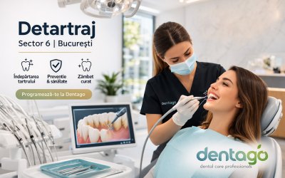 Detartrajul dentar ca revizie auto în sector 6